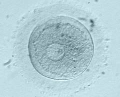 Immature oocyte at the stage of prophase I with visible germinal vesicle.